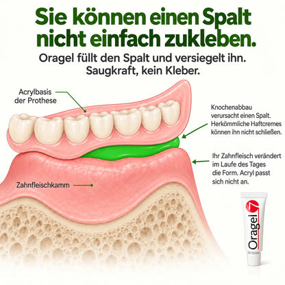 eBook Leitfaden für besseren Prothesenhalt